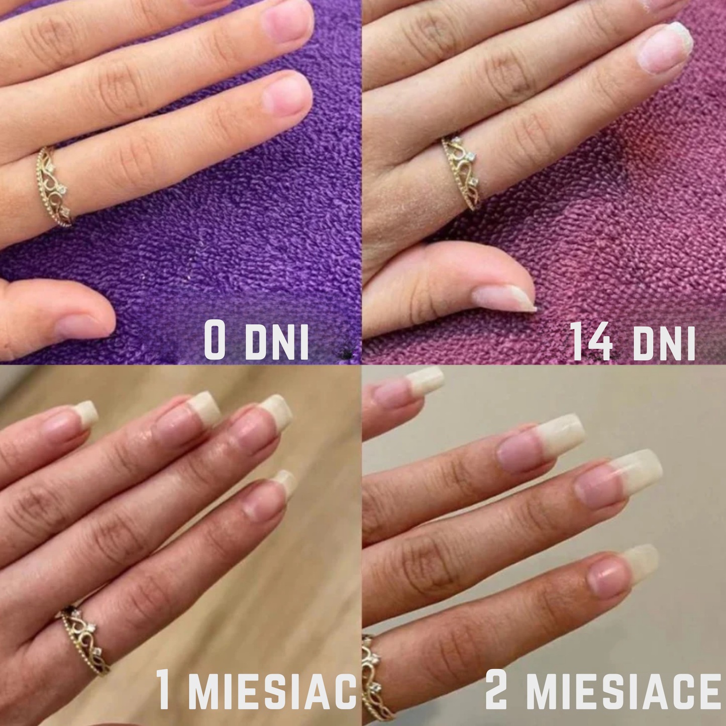 Regenerujące serum do paznokci z komórkami macierzystymi