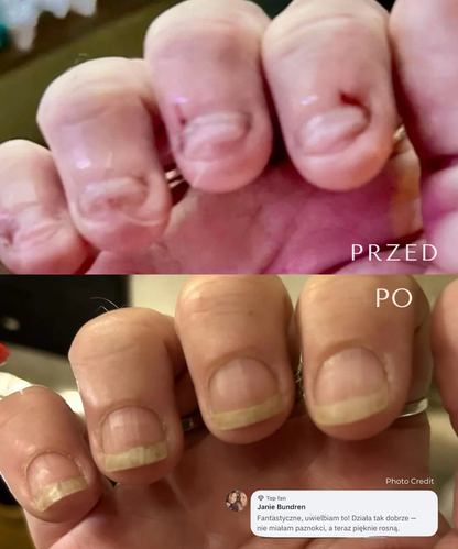 Regenerujące serum do paznokci z komórkami macierzystymi